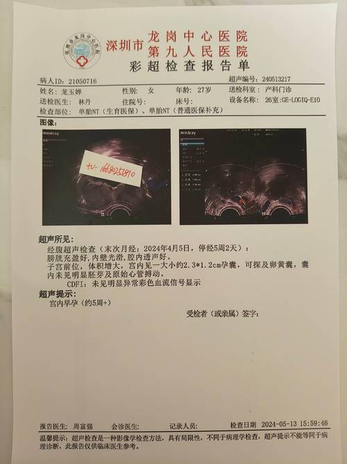 金域检验的结果准吗，金域检验准确率怎么样-第5张图片