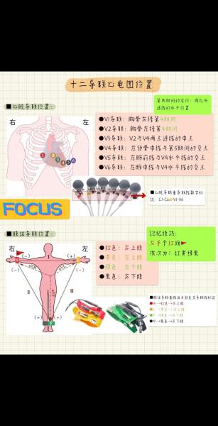 诊断心律失常最有效的检查方法是-第8张图片