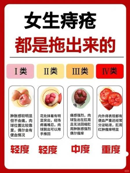 为什么尽量不割痔疮,女性割痔疮的最佳时间-第4张图片 为什么尽量不割痔疮,女性割痔疮的最佳时间-第4张图片