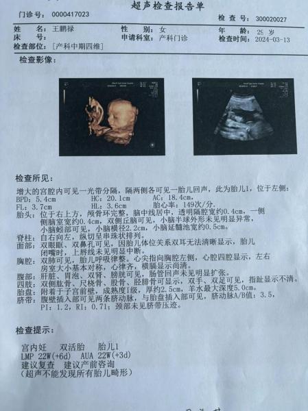 四维彩超几个月做最佳时间/四维彩超几个月做最佳时间多少钱