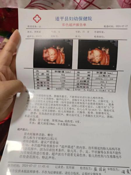 四维彩超几个月做最佳时间/四维彩超几个月做最佳时间多少钱-第3张图片