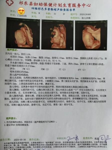 四维彩超几个月做最佳时间/四维彩超几个月做最佳时间多少钱-第4张图片